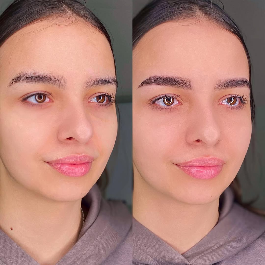 Работа Lawsonia